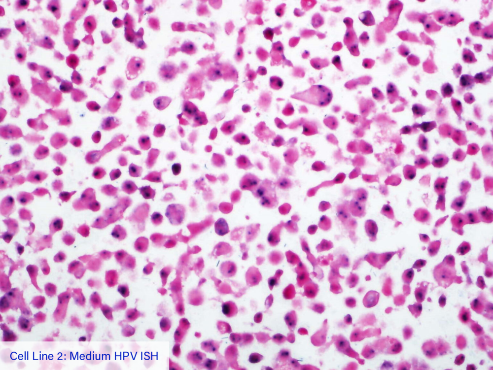 Cell Line 2: Medium HPV ISH