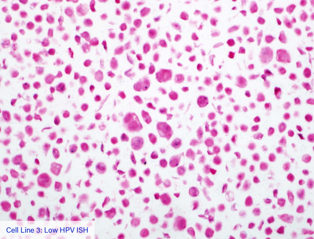 Cell Line 3: Low HPV ISH