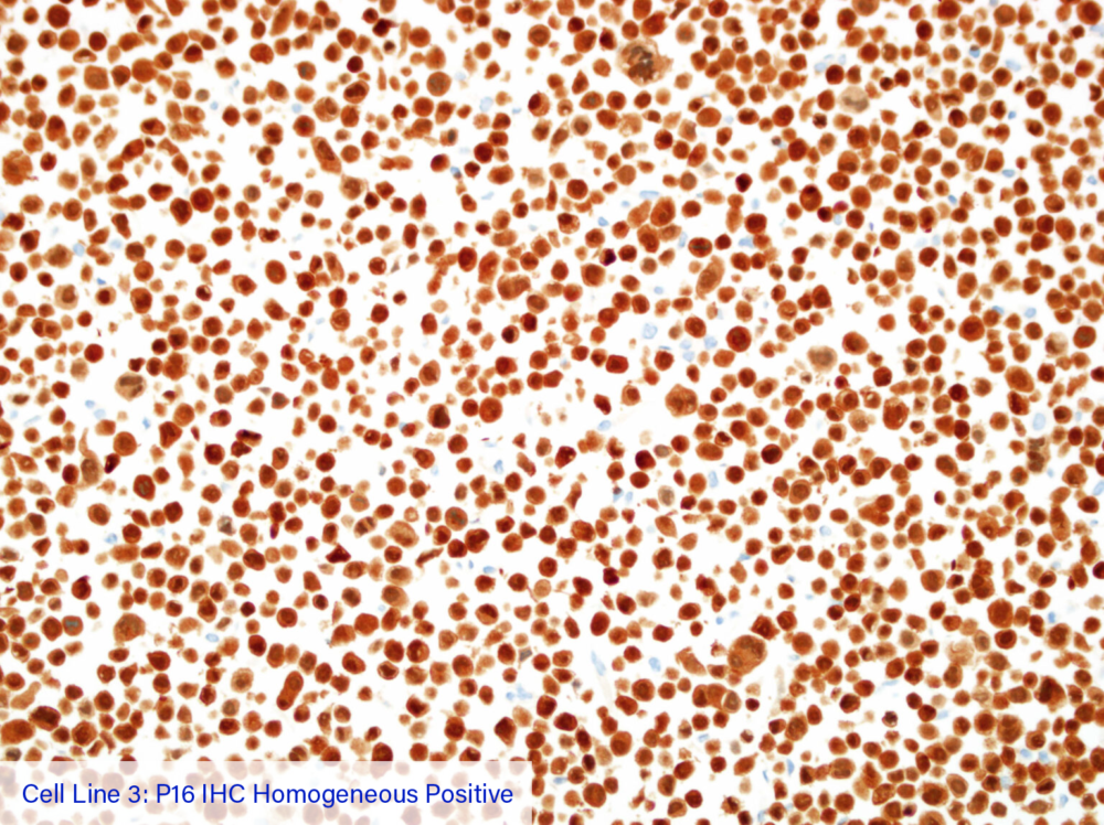 Cell Line 3: P16 IHC Homogeneous Positive