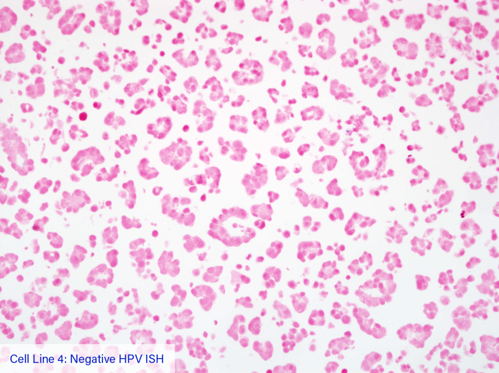 Cell Line 4: Negative HPV ISH