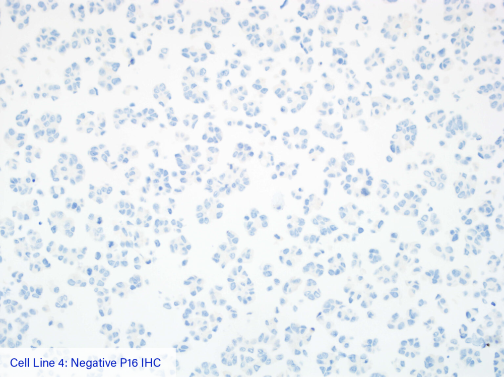 Cell Line 4: Negative P16 IHC