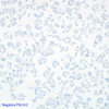 Cell Line 4: Negative P16 IHC