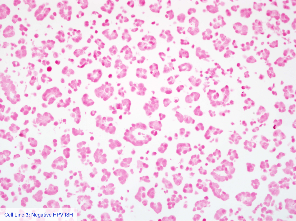 Cell Line 3: Negative HPV ISH