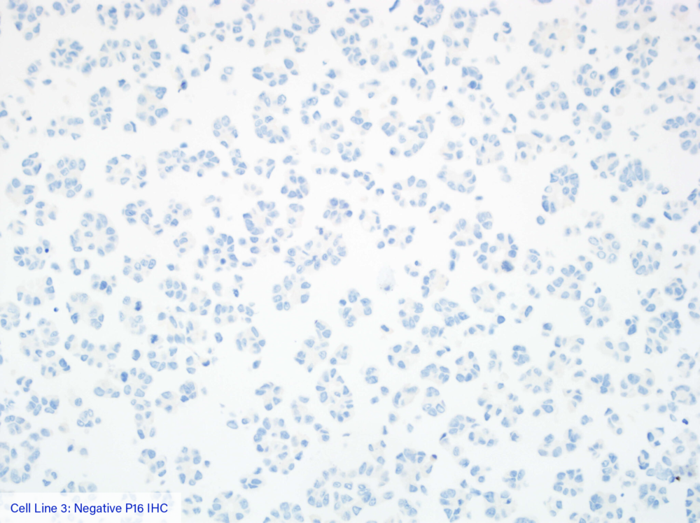 Cell Line 3: Negative P16 IHC