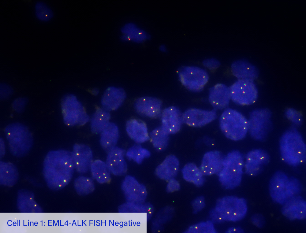 Cell Line 1: EML4-ALK FISH Negative