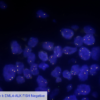 Cell Line 1: EML4-ALK FISH Negative