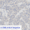 Cell Line 1: EML4-ALK Negative