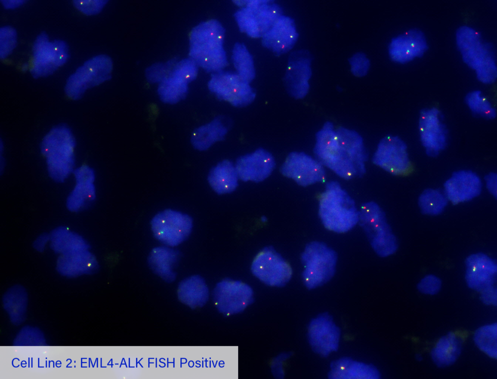 Cell Line 2: EML4-ALK FISH Positive