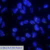 Cell Line 2: EML4-ALK FISH Positive