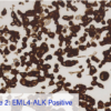 Cell Line 2: EML4-ALK Positive