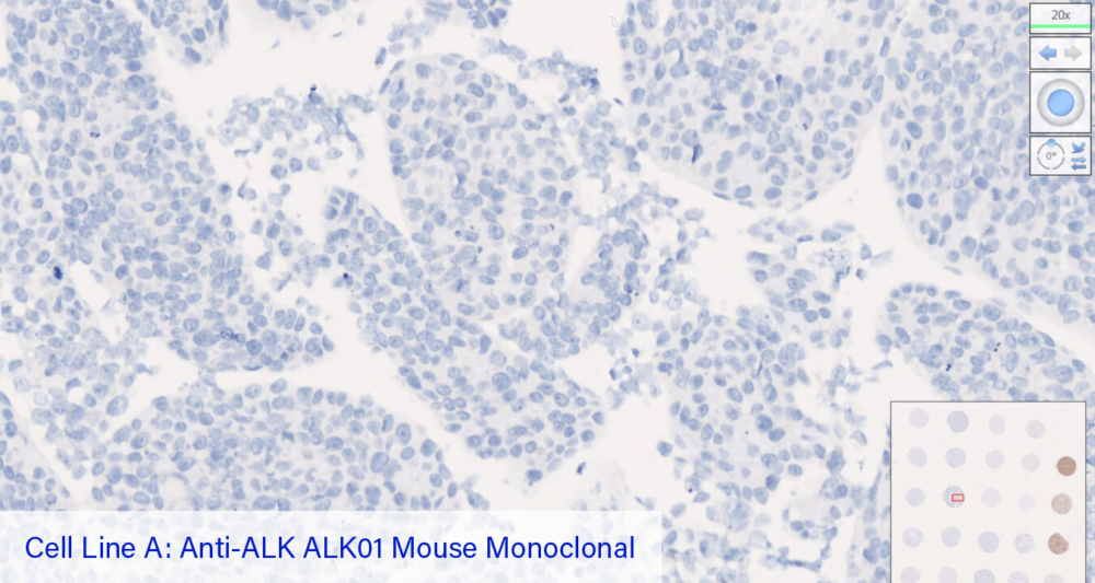 Cell Line A: Anti-ALK ALK01 Mouse Monoclonal