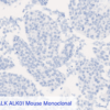 Cell Line A: Anti-ALK ALK01 Mouse Monoclonal