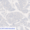 Cell Line A: Anti-ALK D5F3 Rabbit Monoclonal