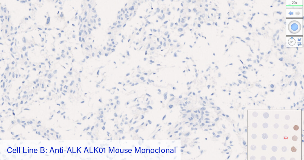 Cell Line B: Anti-ALK ALK01 Mouse Monoclonal