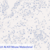 Cell Line B: Anti-ALK ALK01 Mouse Monoclonal