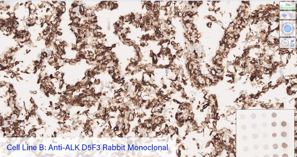 Cell Line B: Anti-ALK D5F3 Rabbit Monoclonal