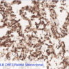 Cell Line B: Anti-ALK D5F3 Rabbit Monoclonal