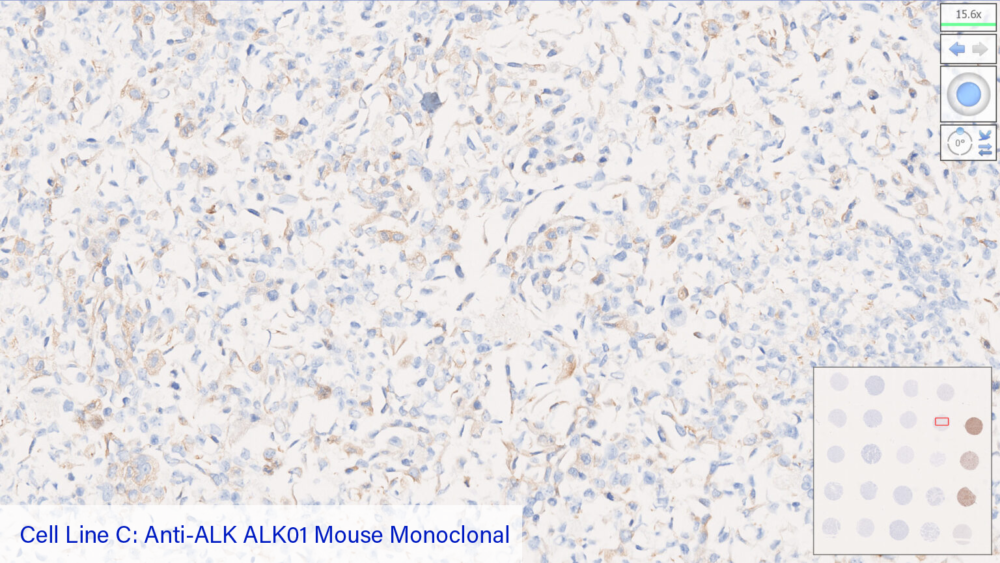 Cell Line C: Anti-ALK ALK01 Mouse Monoclonal