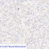 Cell Line C: Anti-ALK ALK01 Mouse Monoclonal