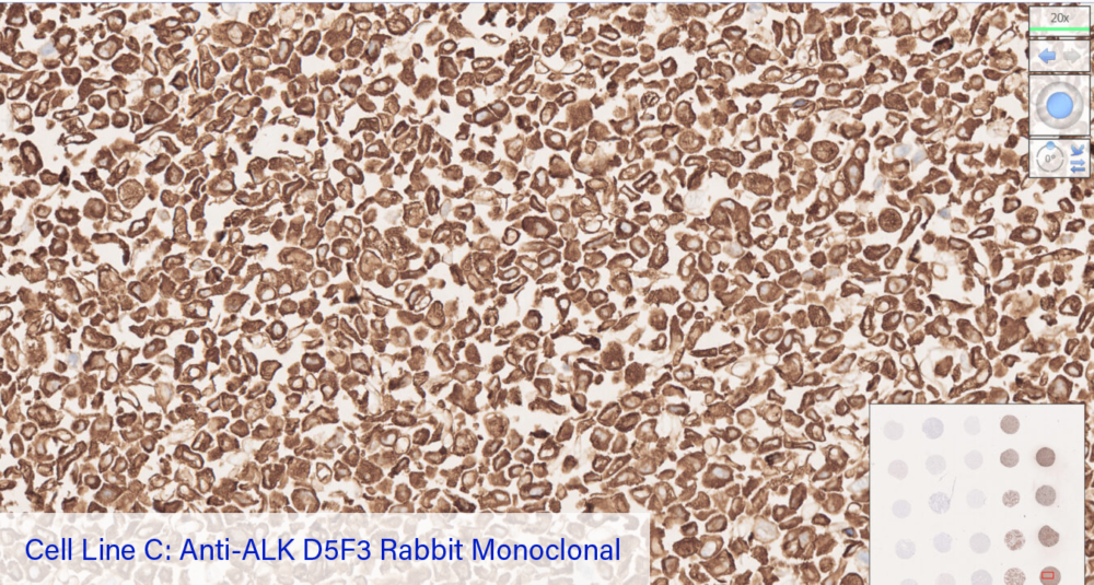 Cell Line C: Anti-ALK D5F3 Rabbit Monoclonal