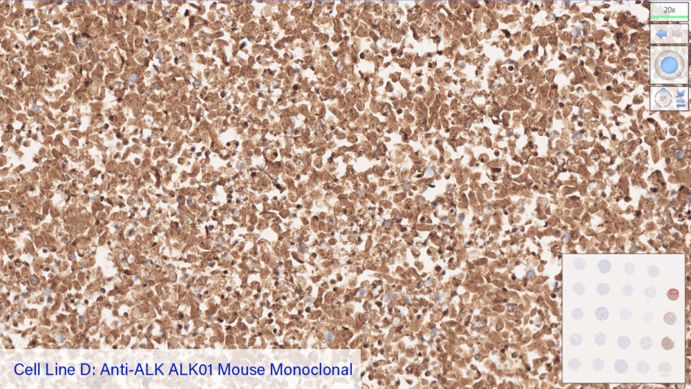 Cell Line D: Anti-ALK ALK01 Mouse Monoclonal