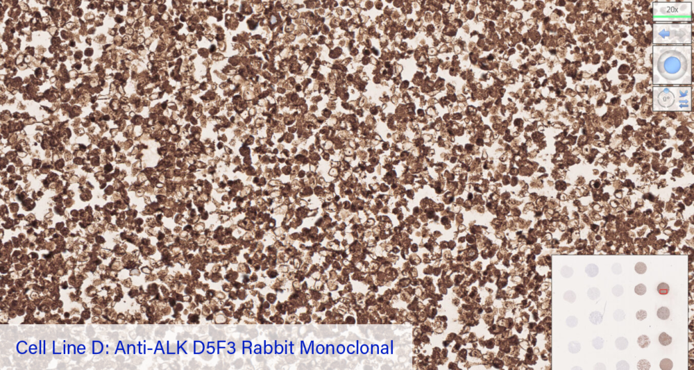 Cell Line D: Anti-ALK D5F3 Rabbit Monoclonal