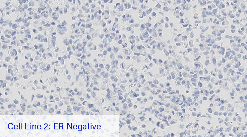 Cell Line 2: ER Negative