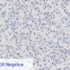 Cell Line 2: ER Negative