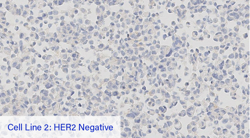 Cell Line 2: HER2 Negative