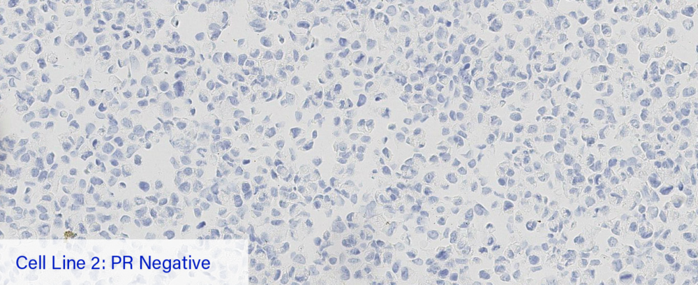 Cell Line 2: PR Negative