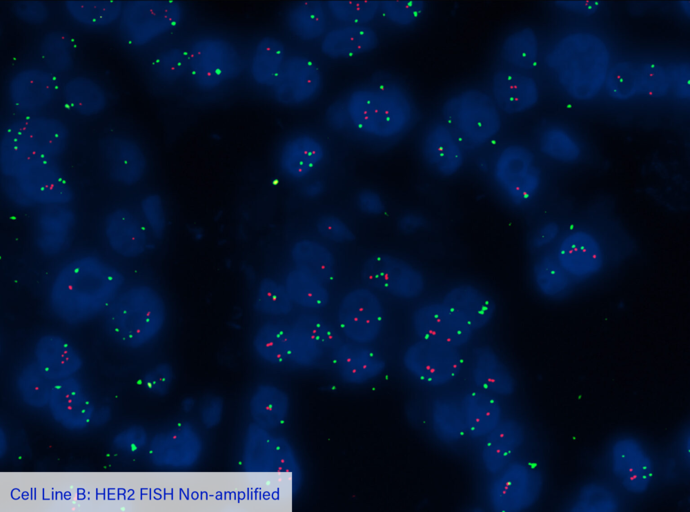 Cell Line B: HER2 FISH Non-amplified