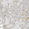 Cell Line B: HER2 IHC 1+