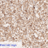 SP384 IHC High