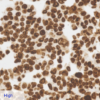 Ki67 quantitative IHC control - high expression