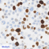 Ki67 quantitative IHC control - medium expression