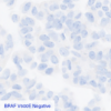 Pan Melanoma CC-BRS2064 BRAF V600E Negative
