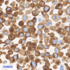 Pan Melanoma CC-BRS2064 HMB45