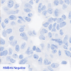 Pan Melanoma CC-BRS2064 HMB45 Negative