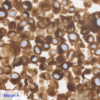 Pan Melanoma CC-BRS2064 Melan A