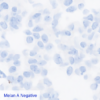 Pan Melanoma CC-BRS2064 Melan A Negative