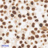 Pan Melanoma CC-BRS2064 PRAME