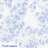 Pan Melanoma CC-BRS2064 PRAME Negative