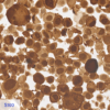 Pan Melanoma CC-BRS2064 S100