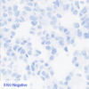 Pan Melanoma CC-BRS2064 S100 Negative