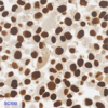 Pan Melanoma CC-BRS2064 SOX10