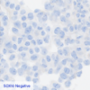 Pan Melanoma CC-BRS2064 SOX10 Negative